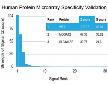 Recombinant WT1 Antibody / Wilm's Tumor