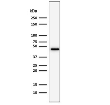 Recombinant CK19 Antibody / Cytokeratin 19