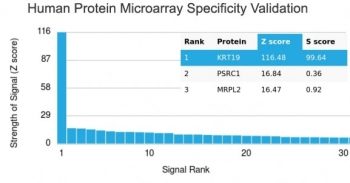 Recombinant Cytokeratin 19 Antibody