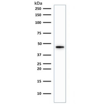 Recombinant KRT19 Antibody / Rabbit Monoclonal