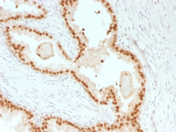 Recombinant FOXA1 Antibody