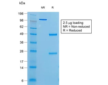 TG Antibody / Thyroglobulin