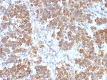 TNFSF15 Antibody / VEGI / TL1A