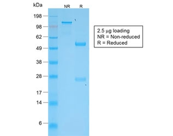 TNFSF15 Antibody / VEGI / TL1A