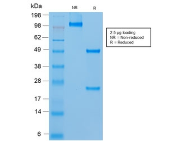 Recombinant CD146 Antibody