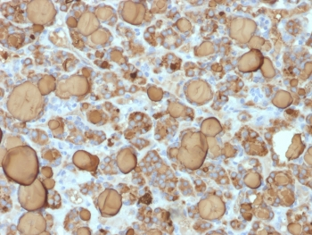 TG Antibody / Thyroglobulin