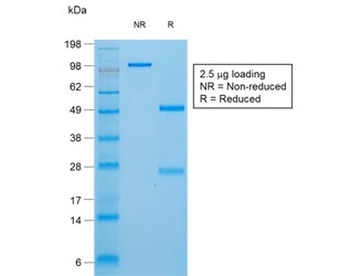 TG Antibody / Thyroglobulin