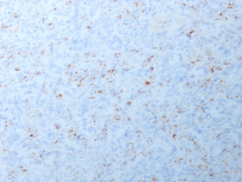 Recombinant MMP3 Antibody / Rabbit Monoclonal