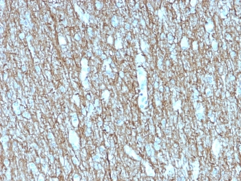 Recombinant Neurofilament Antibody / Heavy