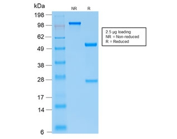 Recombinant PTH Antibody (N-Terminal) / Rabbit Monoclonal