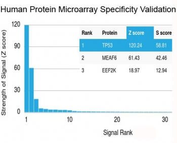 Recombinant TP53 Antibody (N-Terminal Region)