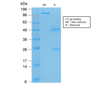 Recombinant TP53 Antibody (N-Terminal Region)