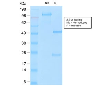 Recombinant MUC16 Antibody / Rabbit Monoclonal
