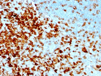 Recombinant CD43 Antibody