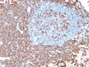 Recombinant CD43 Antibody