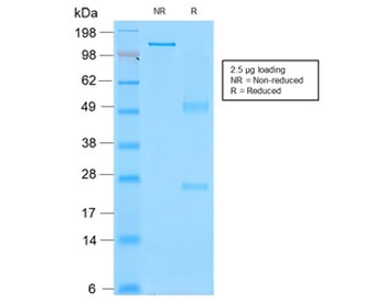 Recombinant CD43 Antibody