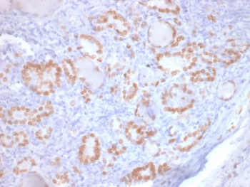 Recombinant TTF-1 Antibody / NKX2.1