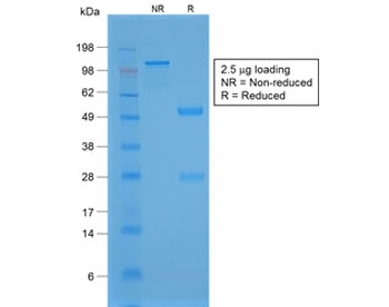 Recombinant NKX2.1 Antibody / TTF-1 Rabbit Monoclonal