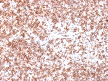 CD45 Antibody (Leukocyte marker)