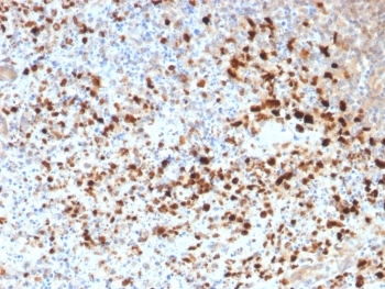 Recombinant HSV1 Antibody / Herpes Simplex Virus Type I
