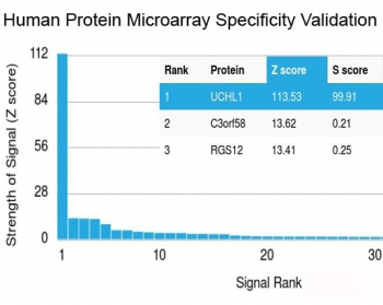 Recombinant PGP9.5 Antibody