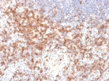 Recombinant CD27 Antibody