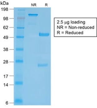 Recombinant CD27 Antibody