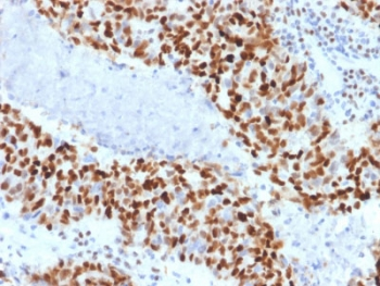 Cyclin E1 Antibody