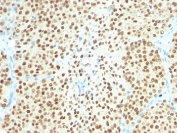 Recombinant SOX10 Antibody