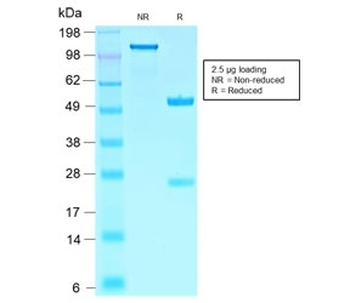 Recombinant SOX10 Antibody