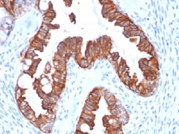 Recombinant Cytokeratin 7 Antibody