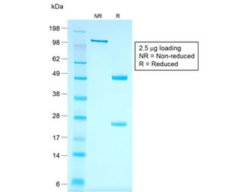 Recombinant Cytokeratin 7 Antibody