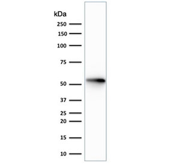 Recombinant Cytokeratin 7 Antibody