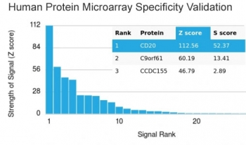 Recombinant CD20 Antibody