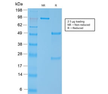 Recombinant SMMHC Antibody