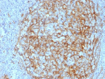 CD14 Antibody (Macrophage Marker)