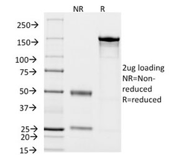 CD14 Antibody (Macrophage Marker)