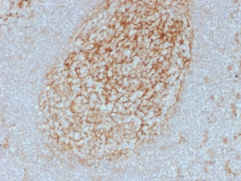 CD14 Antibody (Macrophage Marker)