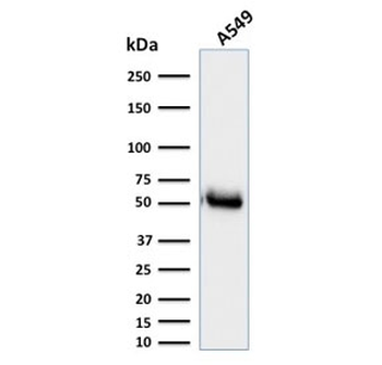 CD14 Antibody (Macrophage Marker)