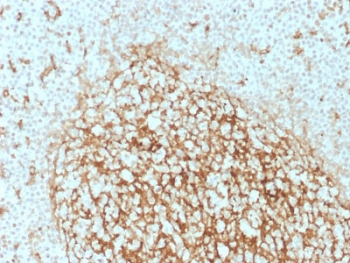 CD14 Antibody (Macrophage Marker)