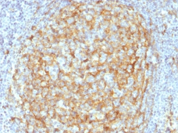 CD14 Antibody (Macrophage Marker)
