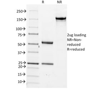 CD14 Antibody (Macrophage Marker)