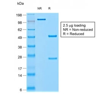Recombinant Chromogranin A Antibody