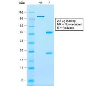 Recombinant Calponin Antibody