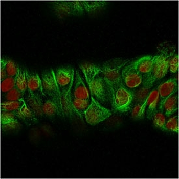 Recombinant Basic Cytokeratin Antibody / Rabbit Monoclonal