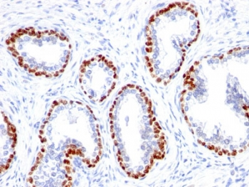 Recombinant p63 Antibody / Rabbit Monoclonal