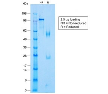 Recombinant p63 Antibody / Rabbit Monoclonal