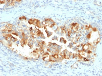 Mesothelin Antibody / MSLN