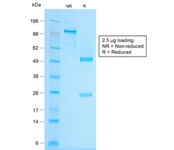 Recombinant Chromogranin A Antibody / Rabbit Monoclonal