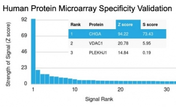 Recombinant Chromogranin A Antibody / Rabbit Monoclonal